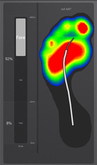 Points de pression du pied 